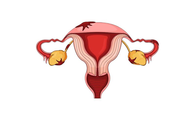 Março Amarelo: Larissa Manoela compartilha diagnóstico de endometriose e reforça importância da informação para mulheres