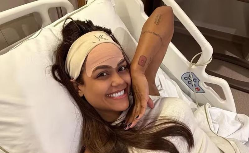 Camila Loures remove veia da testa com técnica moderna a laser na JK Estética Avançada