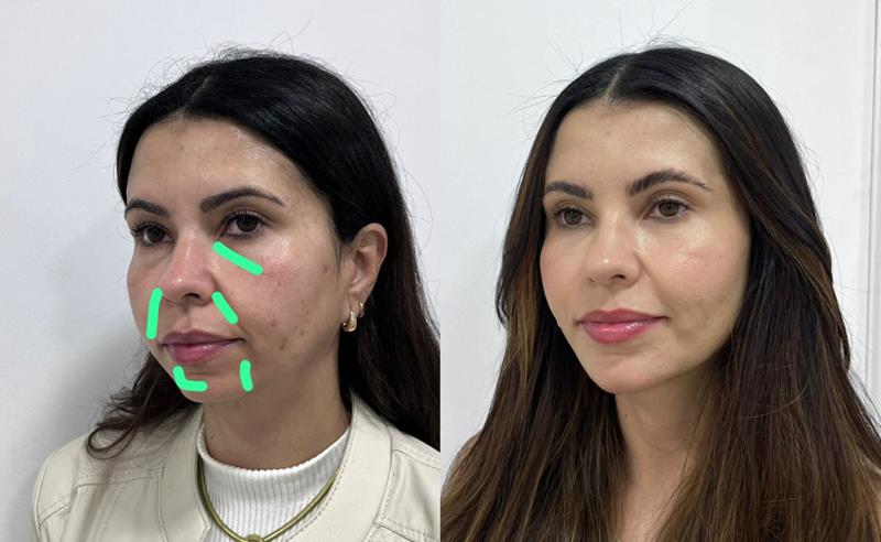 As sombras do rosto denunciam a idade